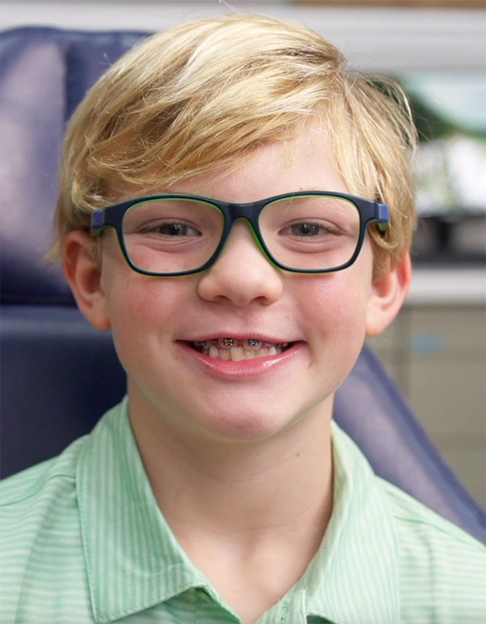 Traditional Braces Gainesville And Lake City FL Orthodontists